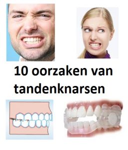 10 oorzaken van tandenknarsen op een rijtje! | | tips tegen knarsetanden!